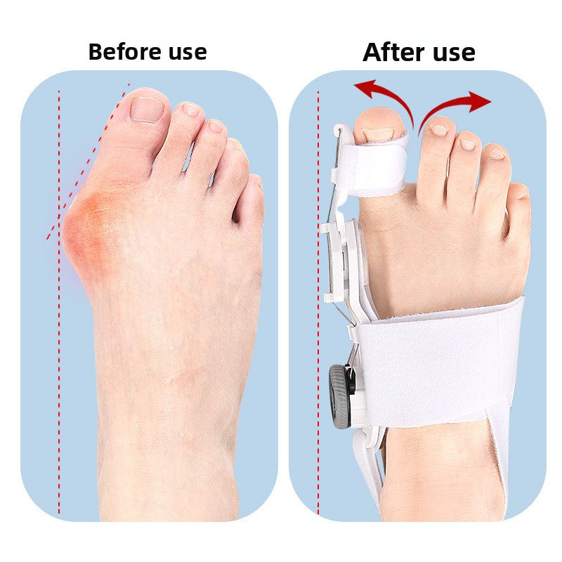 Adjustable Thumb Valgus Orthosis