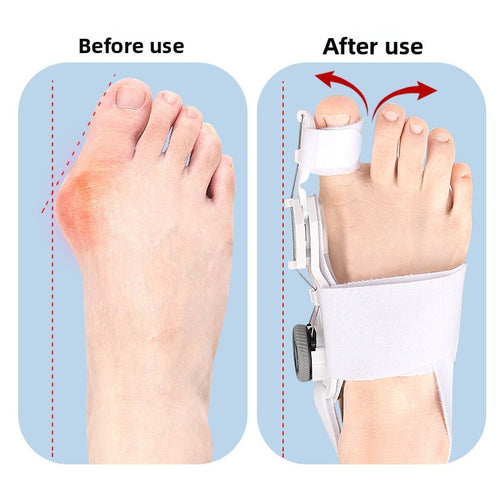 Adjustable Thumb Valgus Orthosis